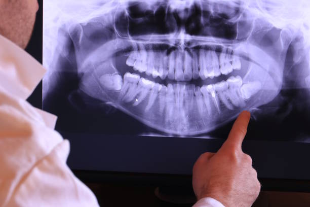 Best Emergency Dental Care for Sports Injuries in Shafer, MN