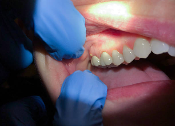 Best Emergency Orthodontic Repairs in Shafer, MN